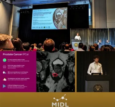 Guerbet wins PI-CAI Grand Challenge on detection of prostate cancer