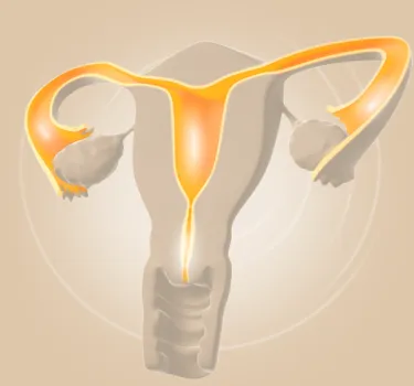 Lipiodol® Ultra Fluid indicated for hysterosalpingography (HSG) in women undergoing infertility workup in Ireland