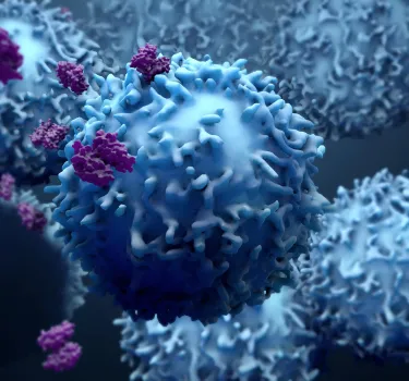 World Cancer Research Day: combining Immunotherapy with interventional radiology for Hepatocellular Carcinoma treatment