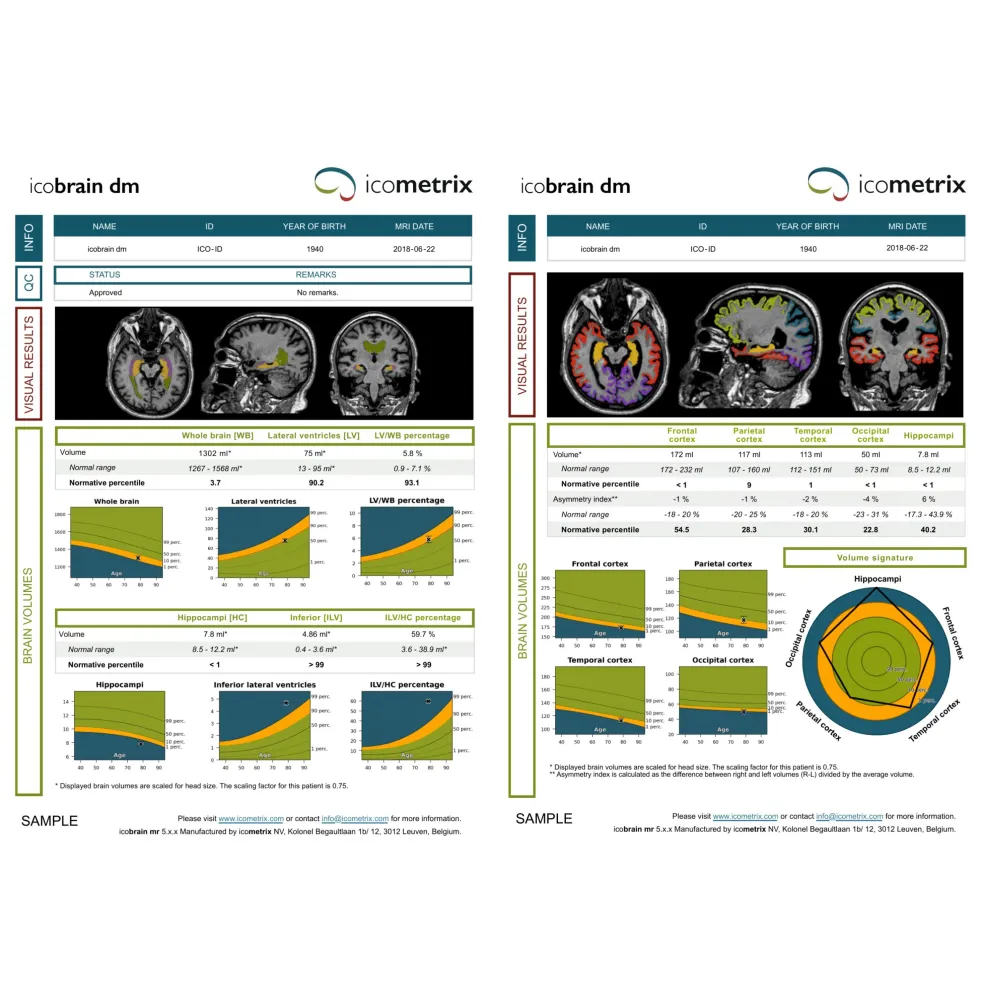 Discover icobrain dm...