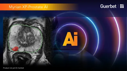 Augmented Intelligence
