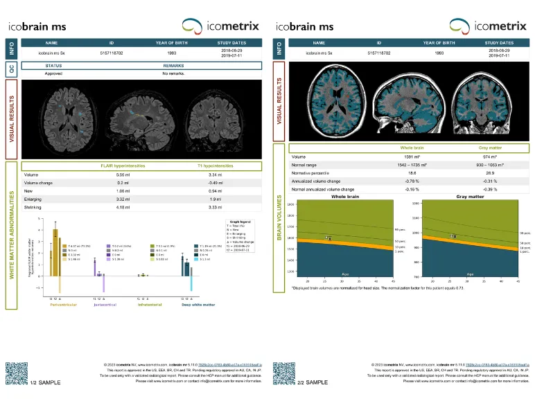 Discover icobrain ms...