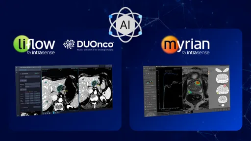 intrasense AI
