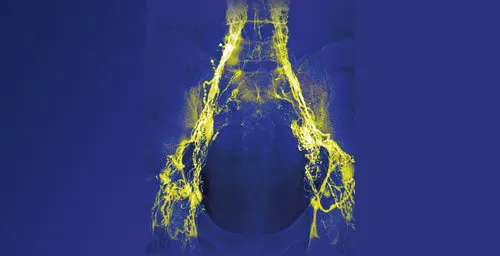 Lymphography