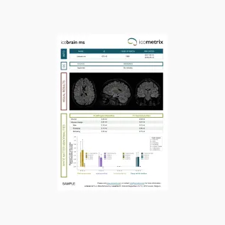icobrain ms